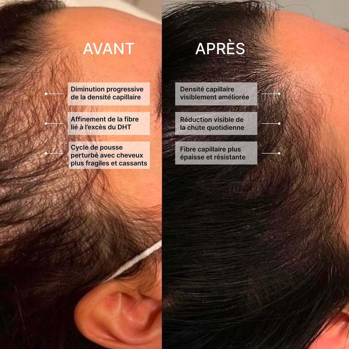 Ebook : Le Guide Ultime pour Stopper la Chute de Cheveux et Stimuler la Repousse